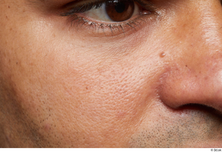 HD Face Skin Henri Sanaky cheek face nose skin pores…